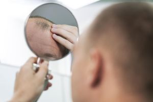 ДГТ і випадіння волосся: що таке гормональна чутливість фолікулів фото